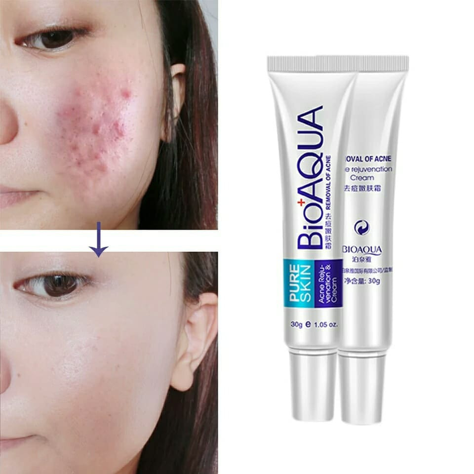 CREMA ANTIACNE BIOAQUA - BIOTEZ